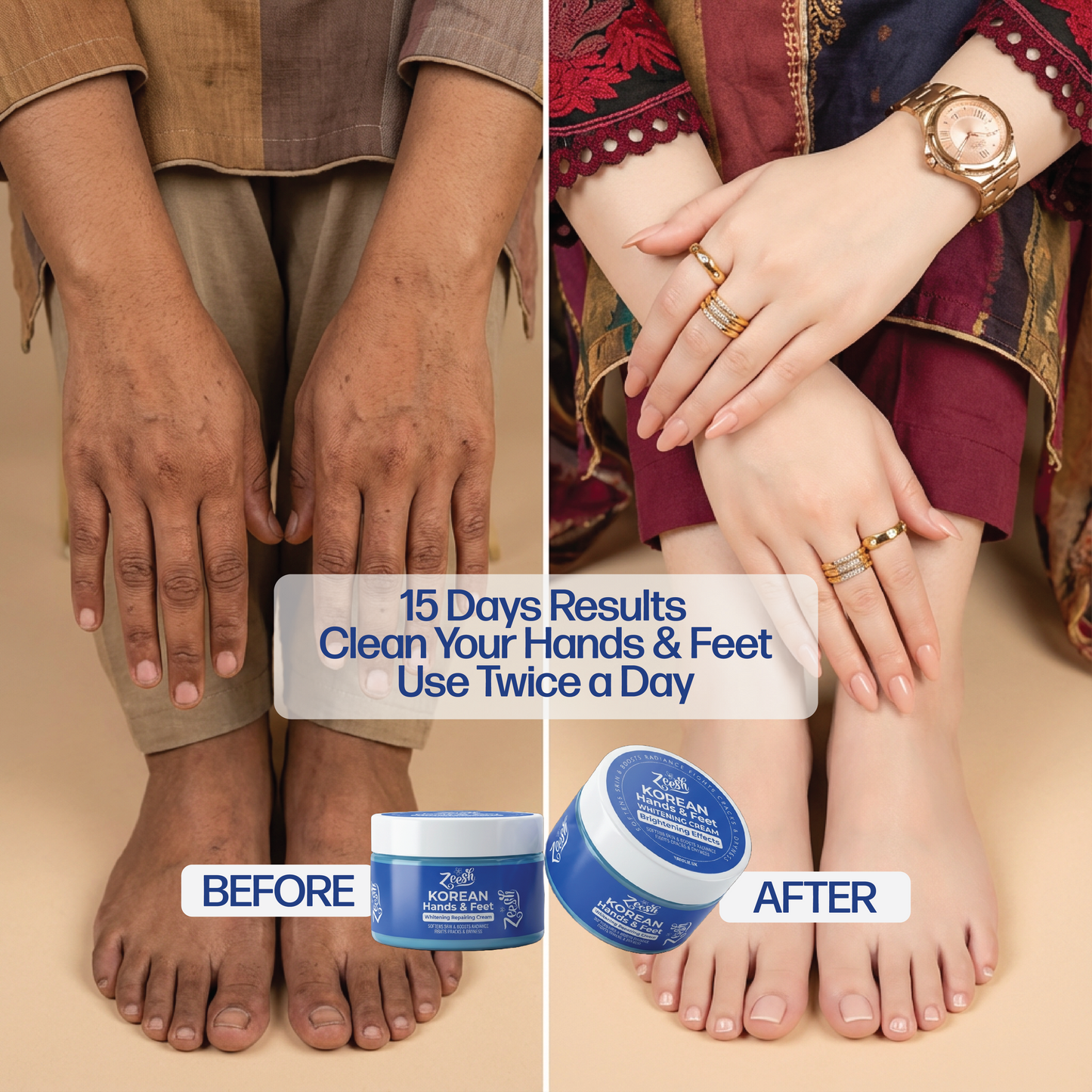 Hands, Feet & Underarm Whitening and Repair Cream for Dark Spots