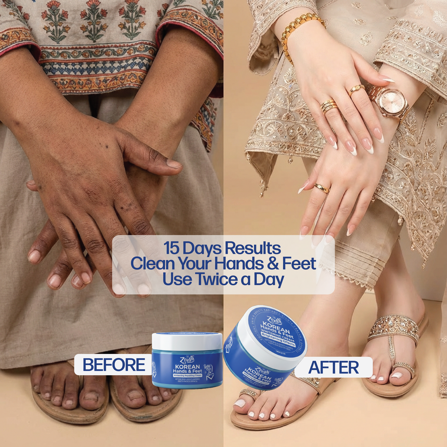 Hands, Feet & Underarm Whitening and Repair Cream for Dark Spots