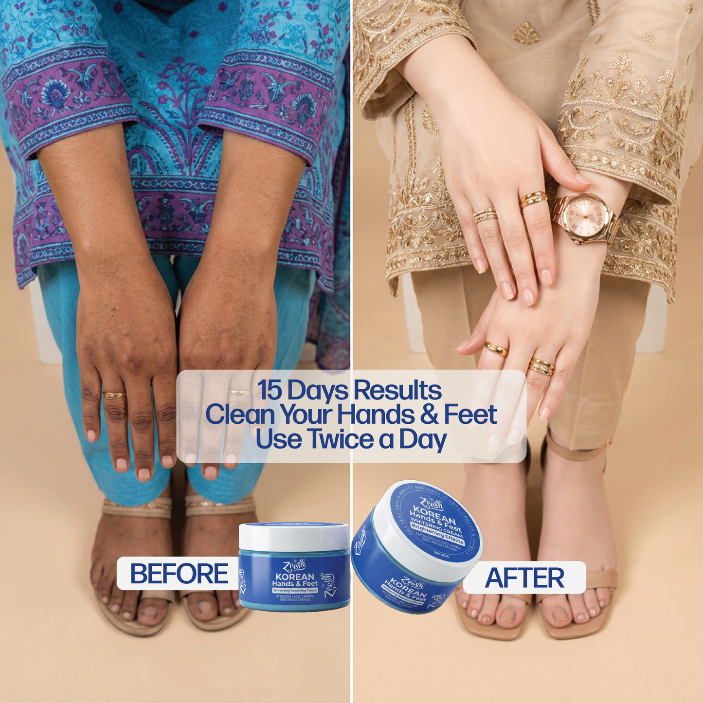 Hands, Feet & Underarm Whitening and Repair Cream for Dark Spots