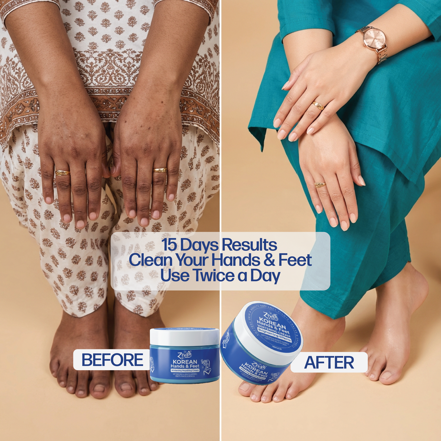 Hands, Feet & Underarm Whitening and Repair Cream for Dark Spots