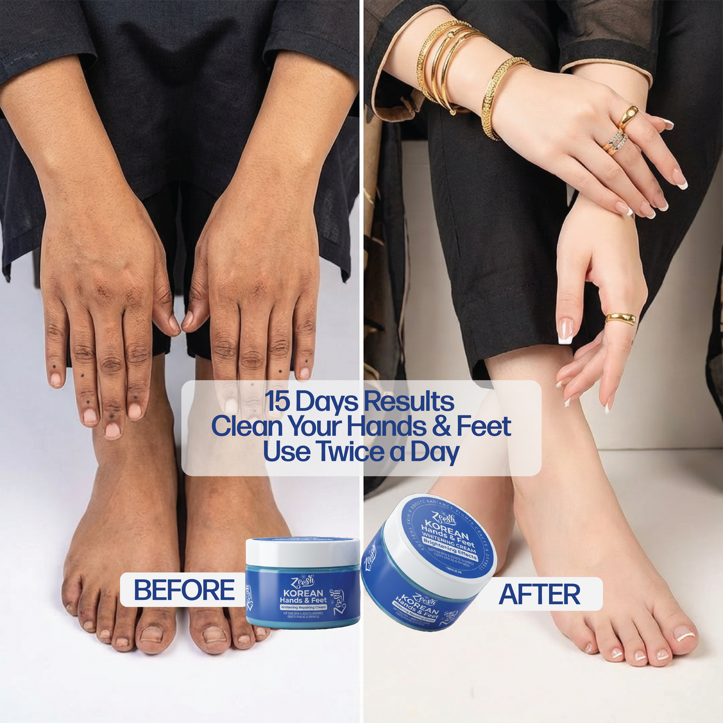 Hands, Feet & Underarm Whitening and Repair Cream for Dark Spots