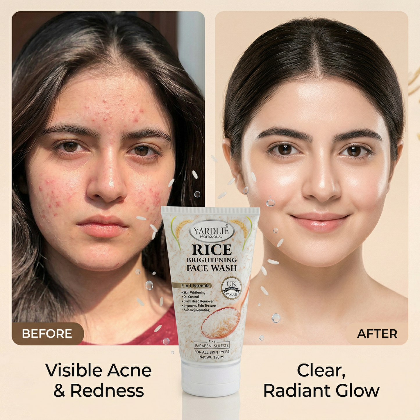Yardlie Rice SkinCare Kit